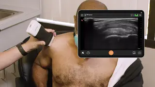Subacromial Bursa Injection - Ultrasound Scanning Technique